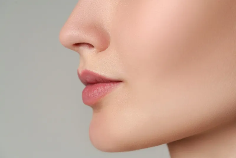 Natural lip filler results showing subtle enhancement
