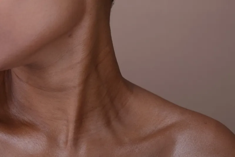 Neck and décolletage skin sagging and crepey texture