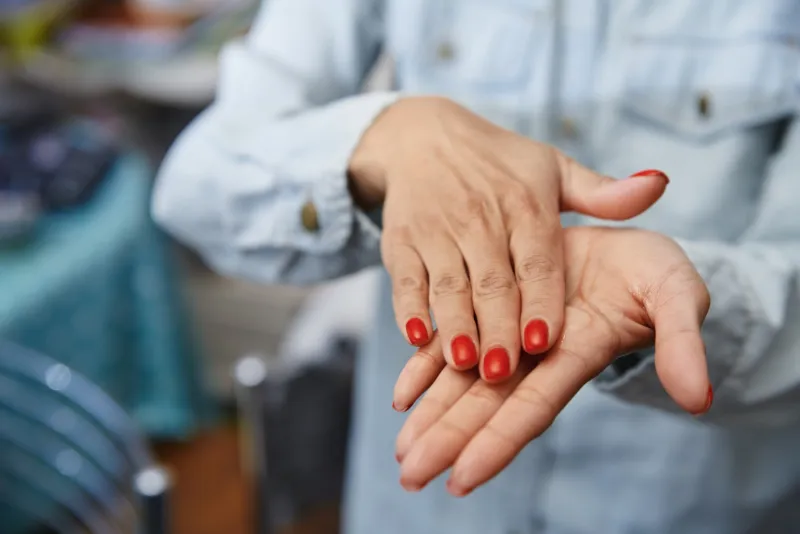 Sweaty hands palmar hyperhidrosis treatment