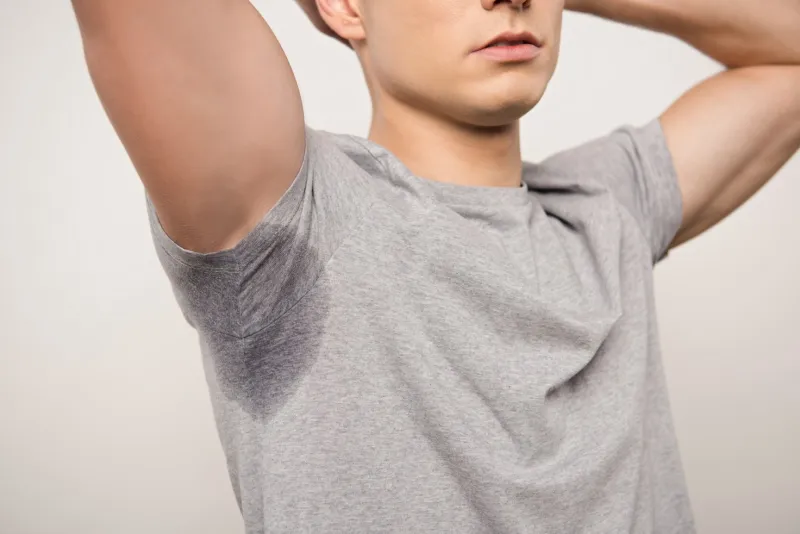 Excessive underarm sweating requiring treatment