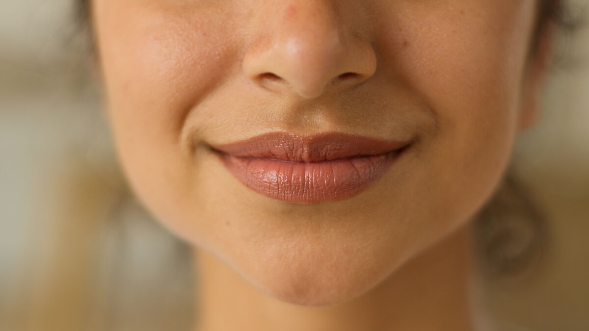Do Lip Fillers Affect Your Smile? - Dermal Fillers article by Dr. Rohit Kumar RK Medical Aesthetics